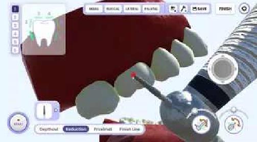 牙医模拟截图(3)