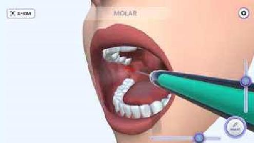 牙医模拟截图(2)
