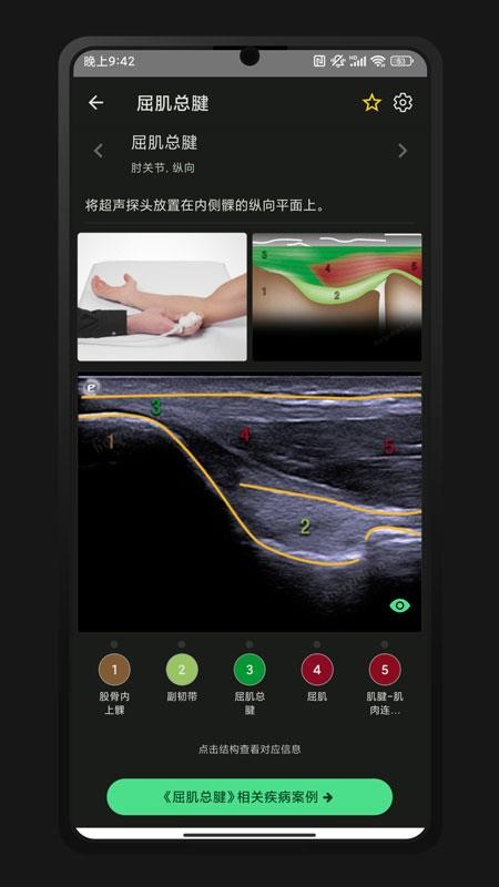 超声智学截图(4)