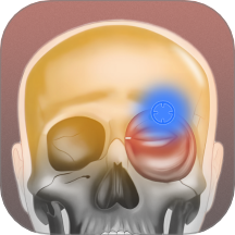 肌肉激痛点图谱